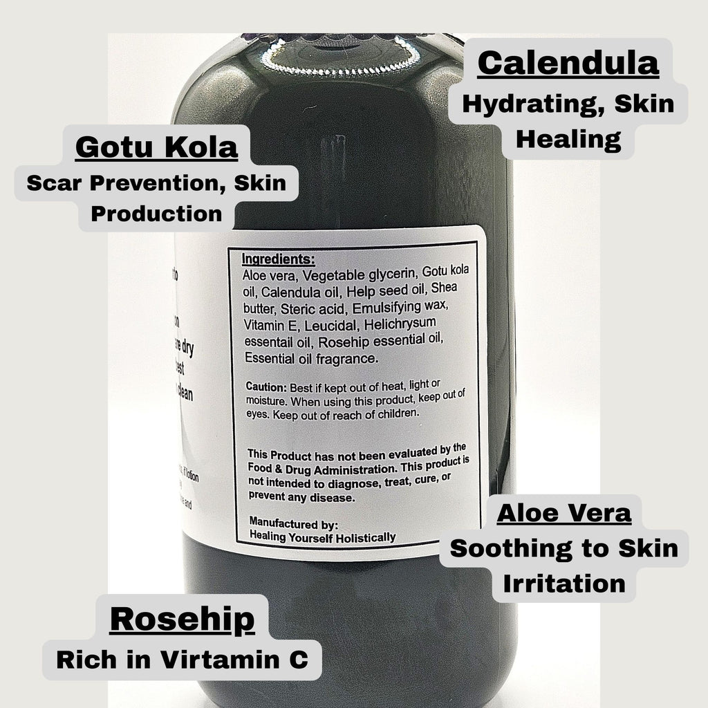 Skin Renew lotion- Intense skin hydration. Skin healing. 8 oz Bottle. 100% natural. Whipped lotion. Handmade.