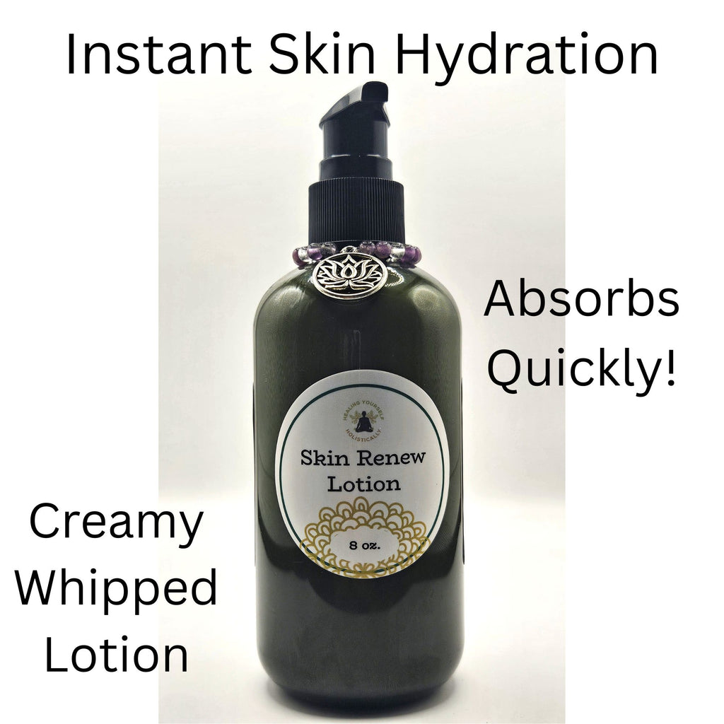 Skin Renew lotion- Intense skin hydration. Skin healing. 8 oz Bottle. 100% natural. Whipped lotion. Handmade.